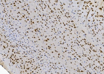 NOVA2 Rabbit Polyclonal Antibody