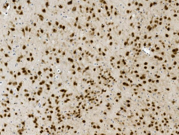 NOVA2 Rabbit Polyclonal Antibody