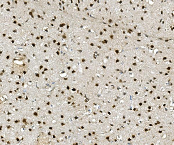 NOVA2 Rabbit Polyclonal Antibody