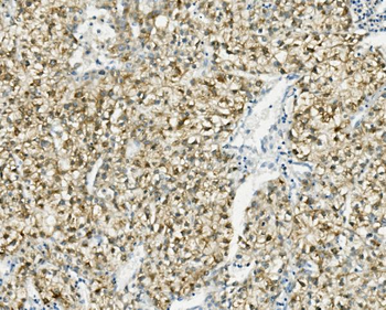 PCK2 Rabbit Polyclonal Antibody