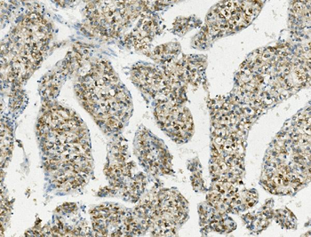 PCK2 Rabbit Polyclonal Antibody