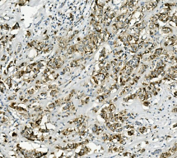 PCK2 Rabbit Polyclonal Antibody