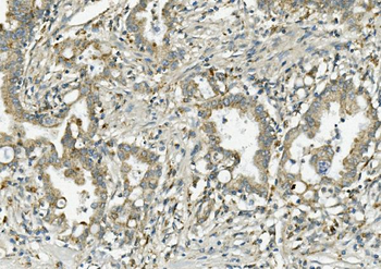 PCK2 Rabbit Polyclonal Antibody
