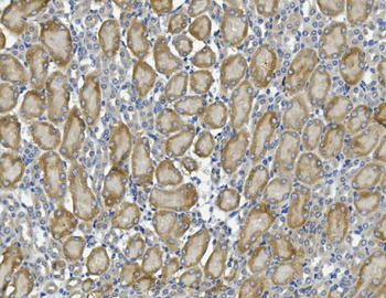 PCK2 Rabbit Polyclonal Antibody