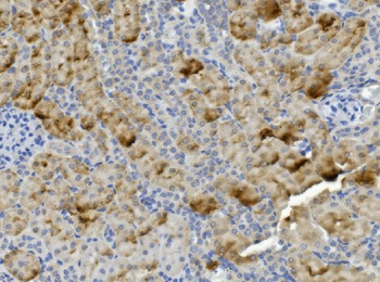 PCK2 Rabbit Polyclonal Antibody