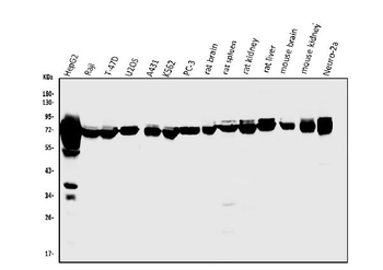 PCK2 Rabbit Polyclonal Antibody