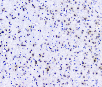 RNA polymerase II/POLR2A Rabbit Polyclonal Antibody