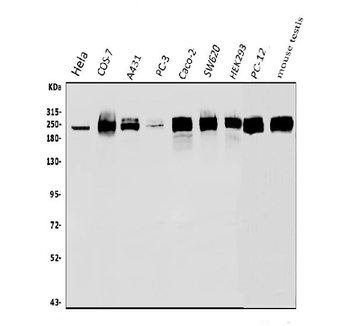 RNA polymerase II/POLR2A Rabbit Polyclonal Antibody