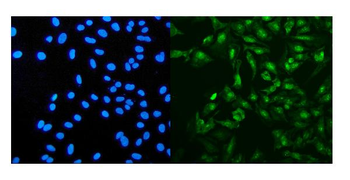 PRDM5 Rabbit Polyclonal Antibody