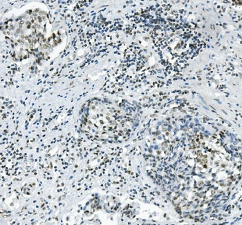 PRDM5 Rabbit Polyclonal Antibody