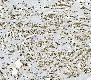 PRDM5 Rabbit Polyclonal Antibody