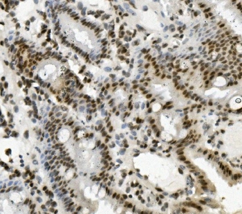 PRDM5 Rabbit Polyclonal Antibody