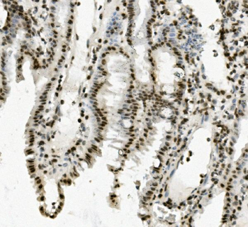 PRDM5 Rabbit Polyclonal Antibody