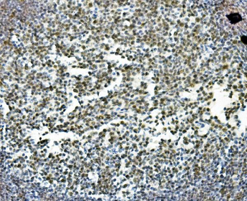 PRDM5 Rabbit Polyclonal Antibody