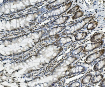 PRDM5 Rabbit Polyclonal Antibody