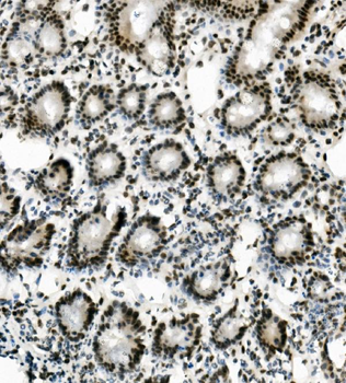 Vinexin/SORBS3 Rabbit Polyclonal Antibody