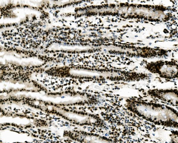 Vinexin/SORBS3 Rabbit Polyclonal Antibody