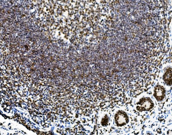 Vinexin/SORBS3 Rabbit Polyclonal Antibody