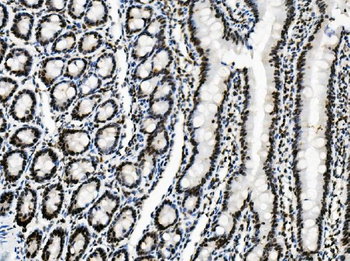 Vinexin/SORBS3 Rabbit Polyclonal Antibody