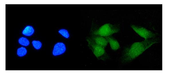 TRIM21/SS-A/SS Rabbit Polyclonal Antibody