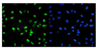 U2AF65/U2AF2 Rabbit Polyclonal Antibody
