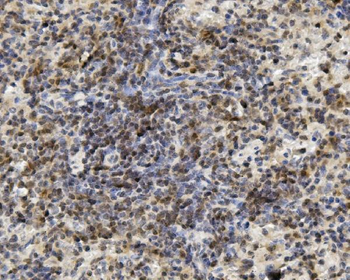 U2AF65/U2AF2 Rabbit Polyclonal Antibody
