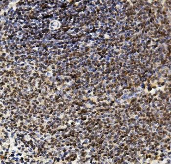 U2AF65/U2AF2 Rabbit Polyclonal Antibody