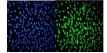 USP16 Rabbit Polyclonal Antibody