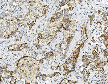 USP16 Rabbit Polyclonal Antibody