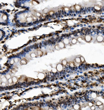 USP16 Rabbit Polyclonal Antibody