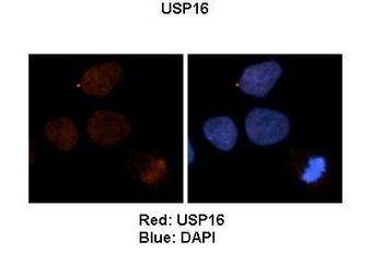 USP16 Rabbit Polyclonal Antibody