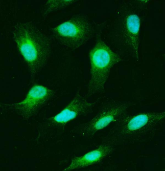 USP25 Rabbit Polyclonal Antibody