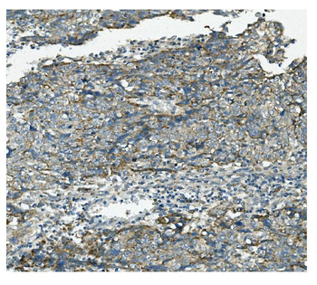 VPS4B/MIG1 Rabbit Polyclonal Antibody