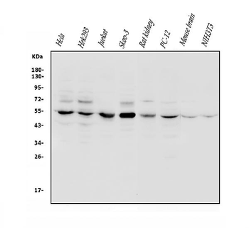 VPS4B/MIG1 Rabbit Polyclonal Antibody