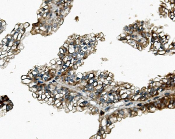 Rex1/ZFP42 Rabbit Polyclonal Antibody