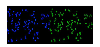 MCM2 Mouse Monoclonal Antibody