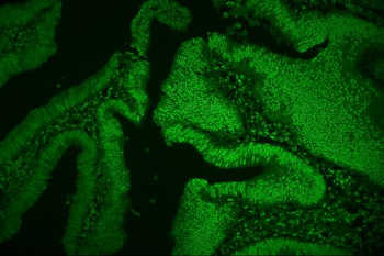 hnRNP D/AUF1/HNRNPD Mouse Monoclonal Antibody