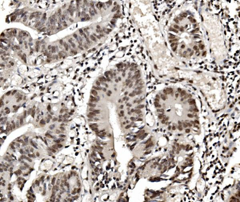 hnRNP D/AUF1/HNRNPD Mouse Monoclonal Antibody