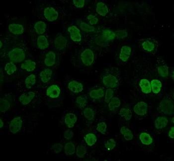 hnRNP D/AUF1/HNRNPD Mouse Monoclonal Antibody