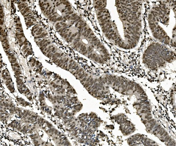 hnRNP D/AUF1/HNRNPD Mouse Monoclonal Antibody