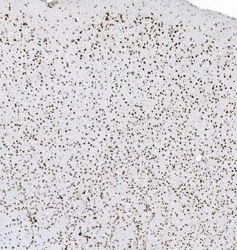 hnRNP D/AUF1/HNRNPD Mouse Monoclonal Antibody