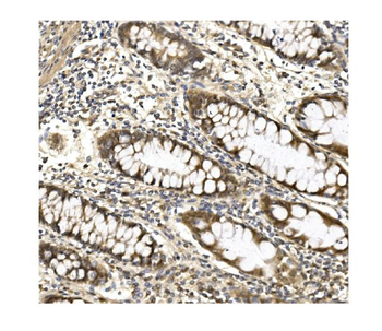 Aconitase 1/ACO1 Antibody