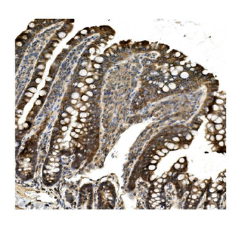 Aconitase 1/ACO1 Antibody