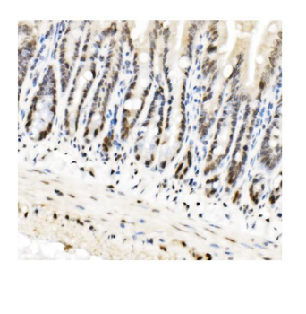 HP1 alpha/CBX5 Antibody