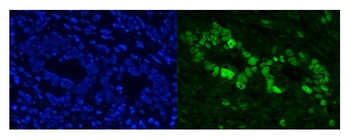Cbx8 Antibody