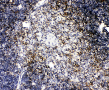 CD4 Rabbit Polyclonal Antibody