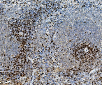 CD8 alpha/Cd8a Rabbit Polyclonal Antibody