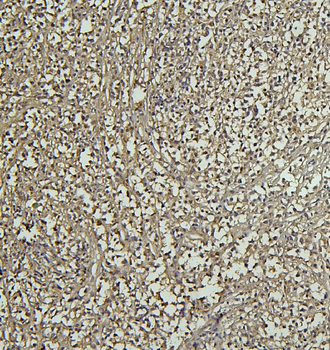 CD69 Antibody