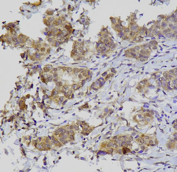 GATA3 Rabbit Polyclonal Antibody