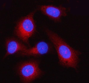 GSDMD Rabbit Polyclonal Antibody